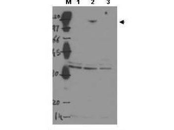 TP53BP2 Antibody