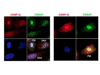 CENPQ Antibody