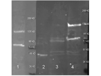 ADA Antibody (HRP)