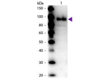 Phospho Enol Pyruvate Carboxylase Antibody