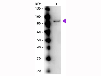 Urease Antibody