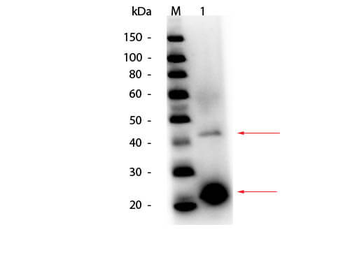 Acid Phosphatase Antibody Peroxidase Conjugated