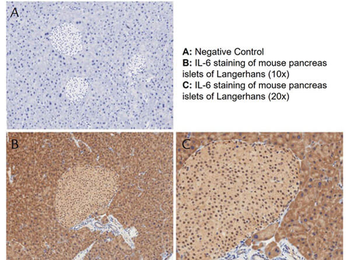 IL-6 Antibody