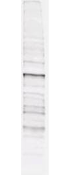 Phosphothreonine Antibody