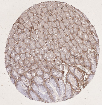 Collagen Type I Antibody