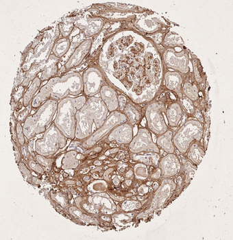 Collagen Type I Antibody