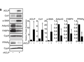 Collagen Type I Antibody