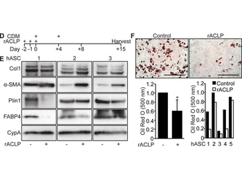Collagen Type I Antibody