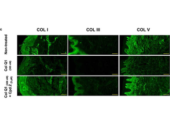 Collagen Type I Antibody