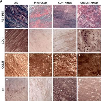 Collagen Type I Antibody