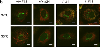 Collagen Type I Antibody