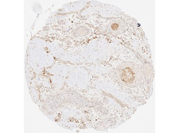 Collagen Type III Antibody