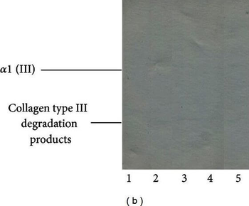 Collagen Type III Antibody