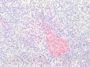 Collagen Type III Antibody