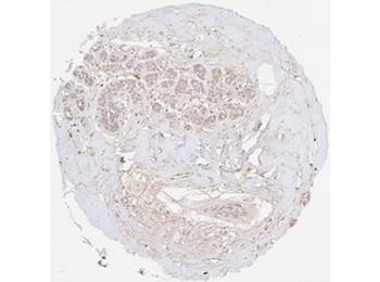 Collagen Type III Antibody