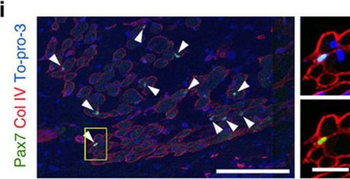 Collagen Type IV Antibody
