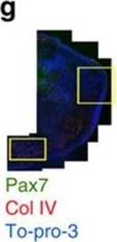 Collagen Type IV Antibody