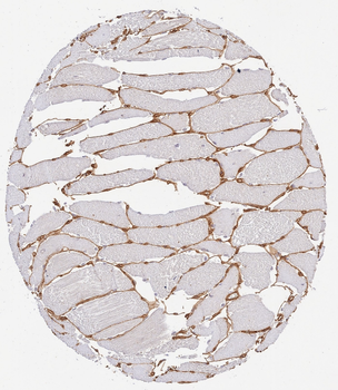Collagen Type IV Antibody