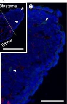 Collagen Type IV Antibody