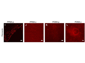 FN1 Antibody