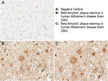 Beta Amyloid Antibody