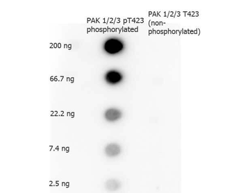 PAK1 Antibody