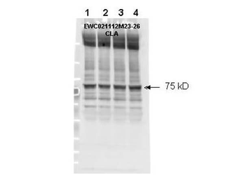 NF2 Antibody