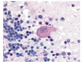 HTT Antibody