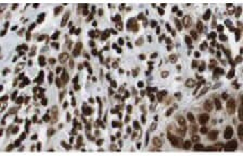 HDAC1 Antibody