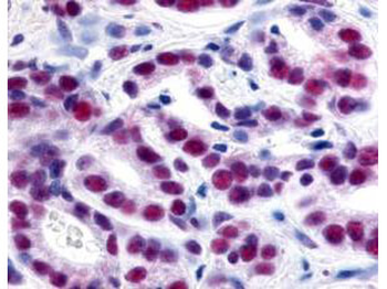 HDAC1 Antibody