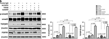 SMAD3 phospho S423/phospho S425 Antibody