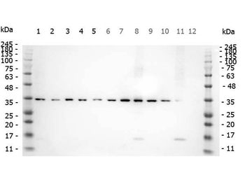SMAD3 phospho S423/phospho S425 Antibody
