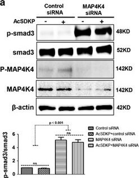 SMAD3 phospho S423/phospho S425 Antibody
