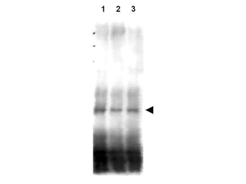 MER2, REC107 Antibody