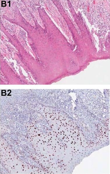 Pdcd4 phospho S457 Antibody