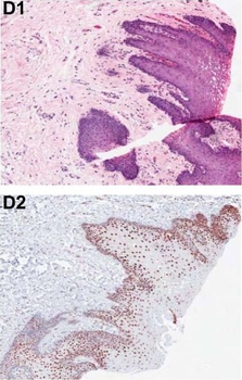 Pdcd4 phospho S457 Antibody
