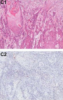 Pdcd4 phospho S457 Antibody