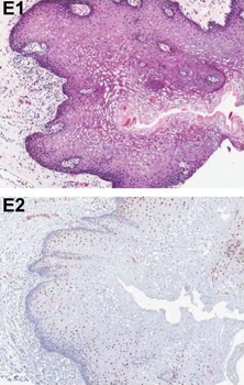 Pdcd4 phospho S457 Antibody