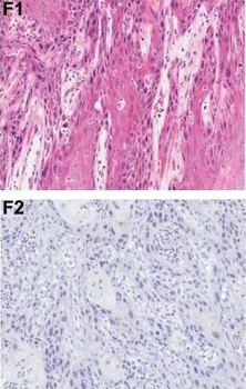 Pdcd4 phospho S457 Antibody