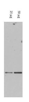 DAXX Antibody