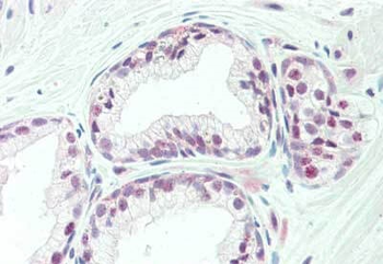 TAF1 Antibody