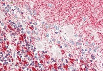 CENPU Antibody