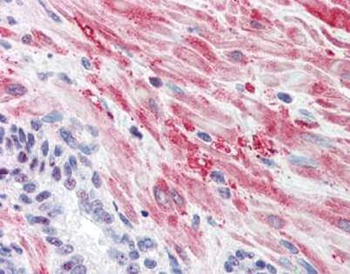 GYS1 Antibody