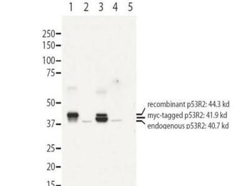 RRM2B Antibody