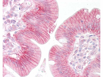 ctnnb1 Antibody