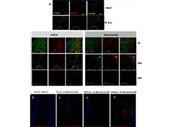 Human IgG (H&L) Antibody Texas Red Conjugated Pre-Adsorbed