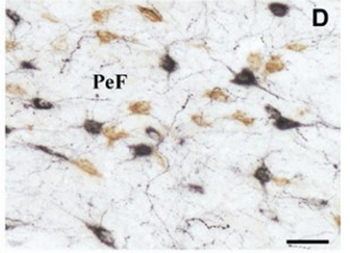 Rabbit IgG (H&L) Antibody Biotin Conjugated