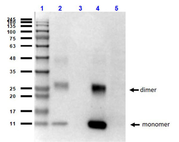 HBB Antibody