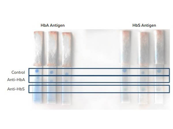 HBB Antibody