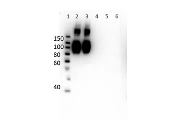 HBB Antibody